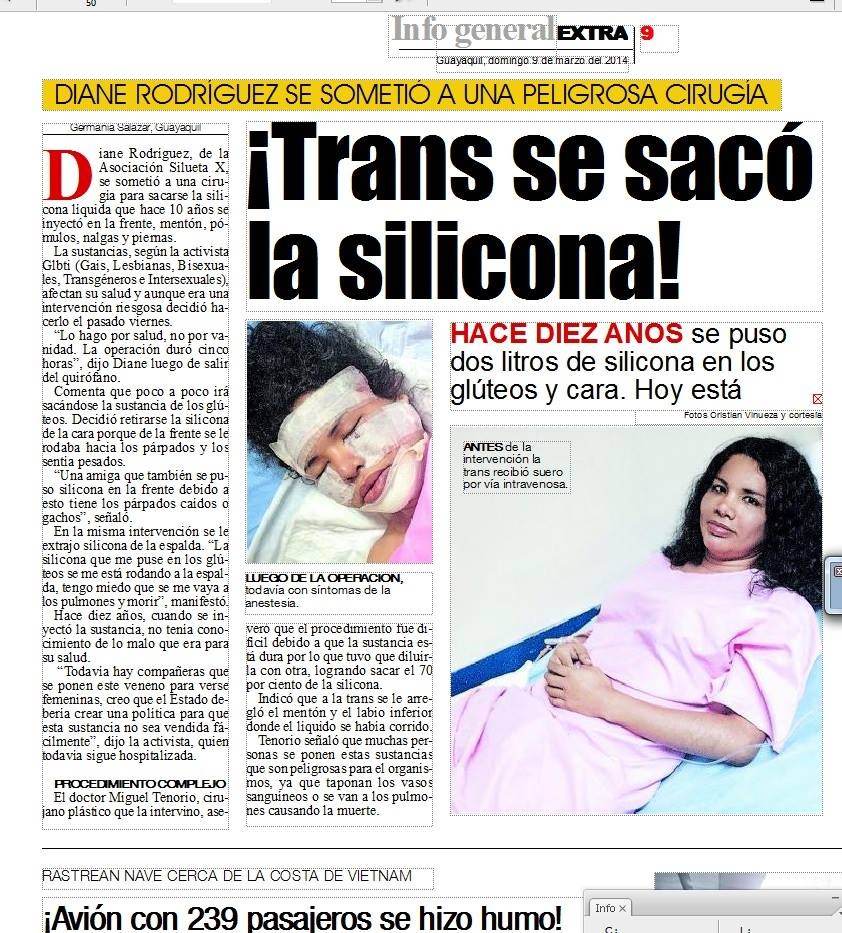 Diane Rodriguez se sometió a una cirugía riesgosa.-Siluetax-DianeRodriguez